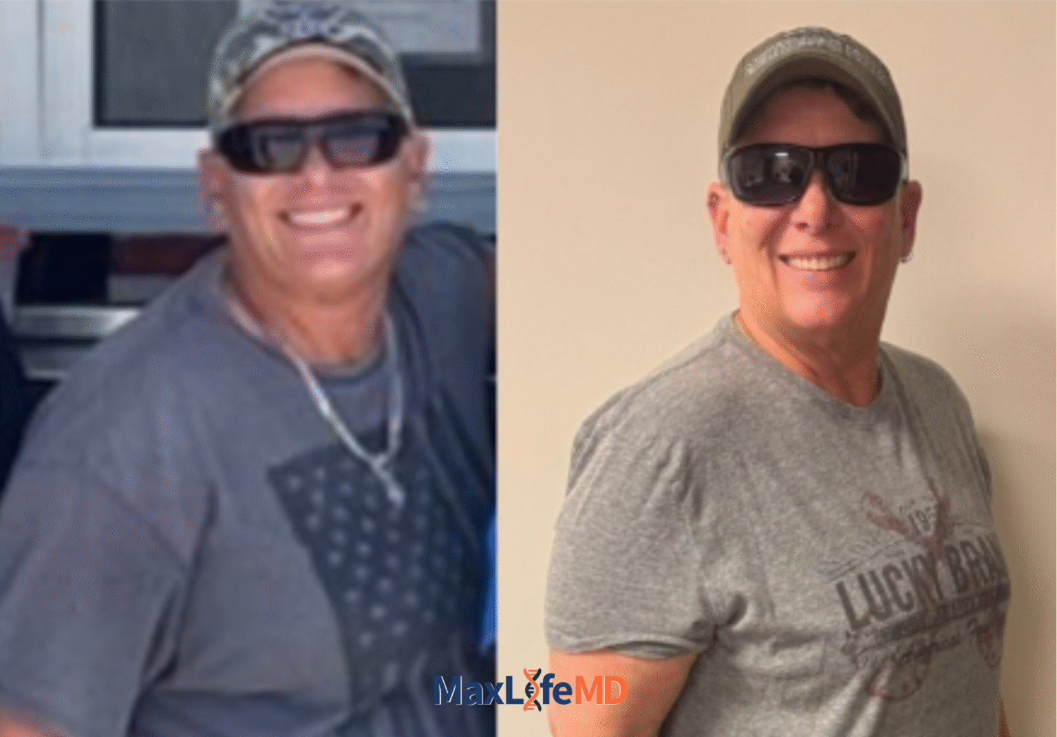 MaxLife MD Website GLP1 Tirzepatide NAD Energy Lose Weight Lose Fat Women 11