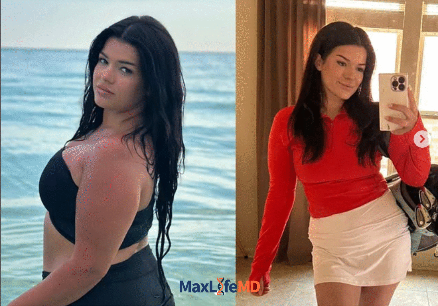 MaxLife MD Website GLP1 Tirzepatide NAD Energy Lose Weight Lose Fat Women 13