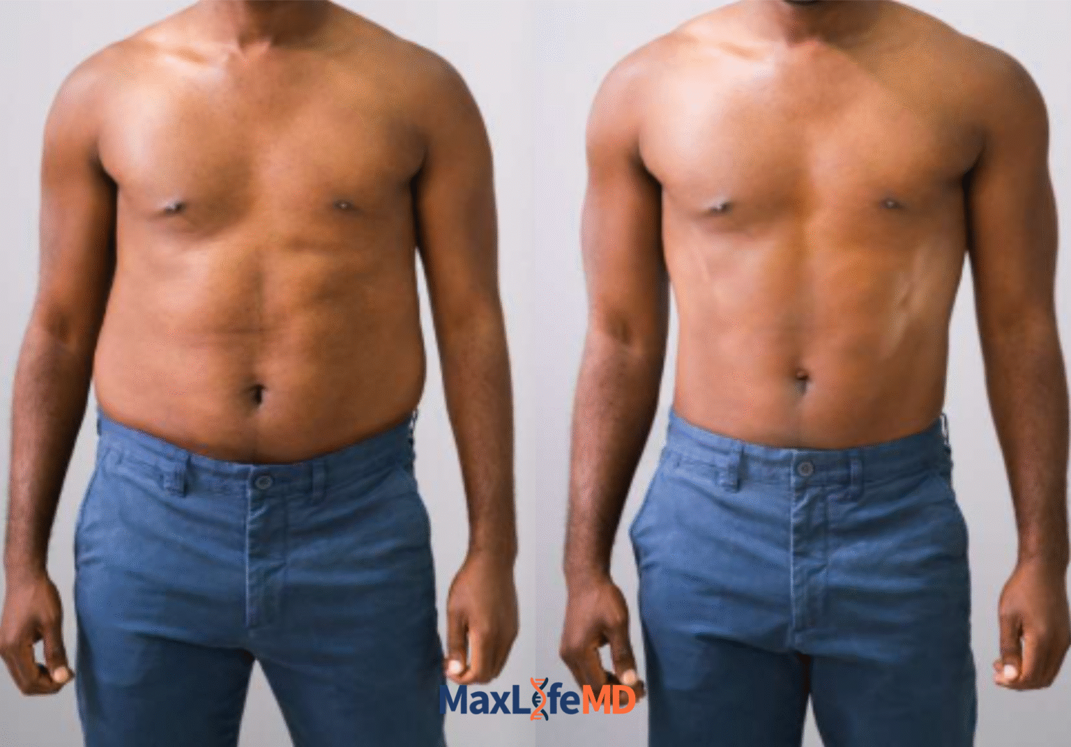 MaxLife MD Website GLP1 Tirzepatide NAD Energy Lose Weight Lose Fat Women 2