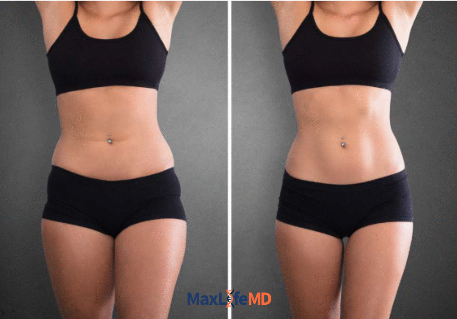 MaxLife MD Website GLP1 Tirzepatide NAD Energy Lose Weight Lose Fat Women 3