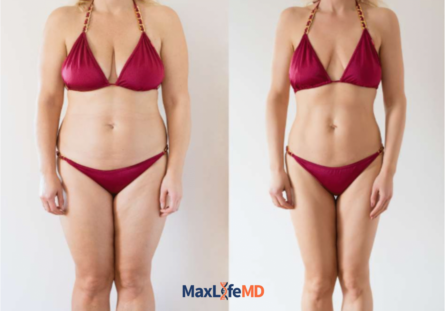 MaxLife MD Website GLP1 Tirzepatide NAD Energy Lose Weight Lose Fat Women 4