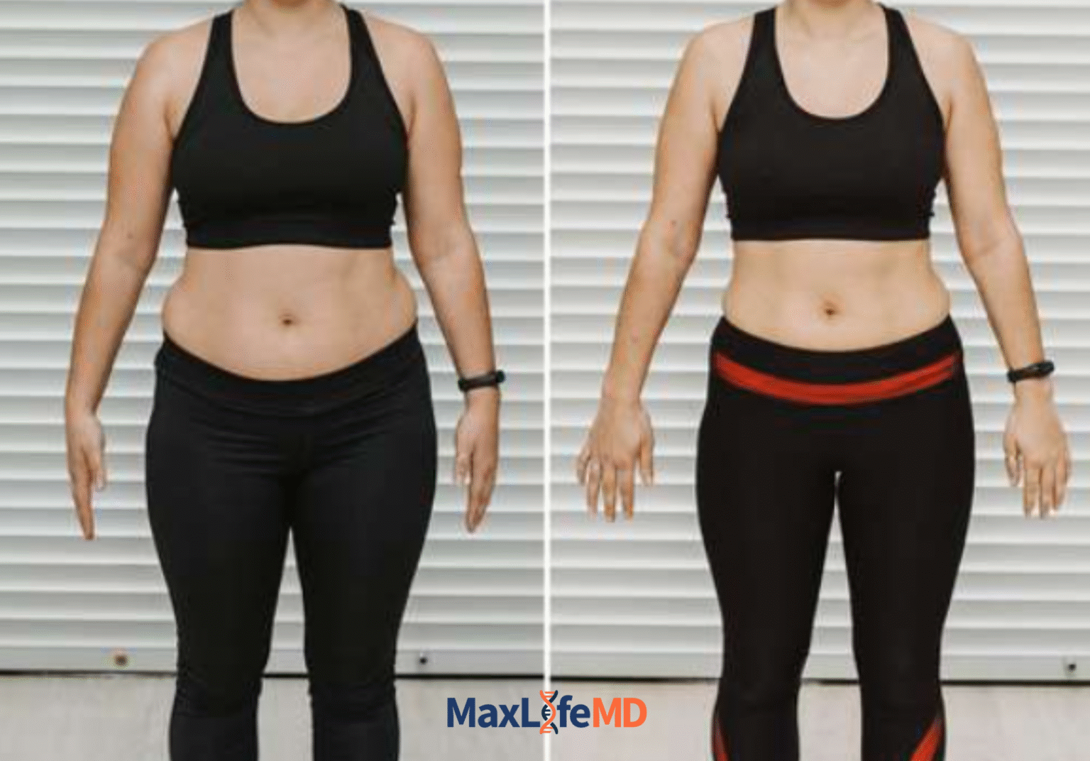 MaxLife MD Website GLP1 Tirzepatide NAD Energy Lose Weight Lose Fat Women 5