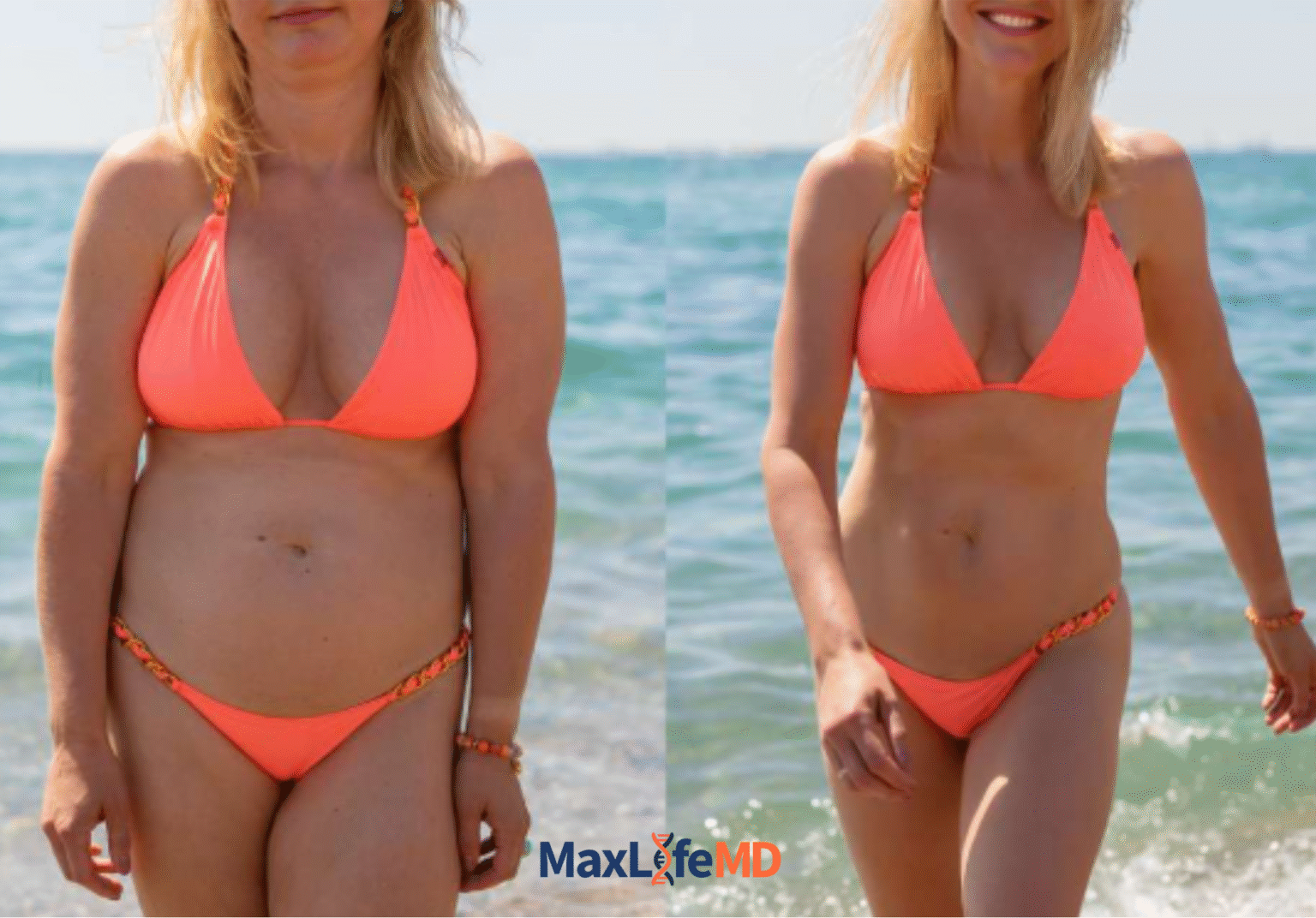 MaxLife MD Website GLP1 Tirzepatide NAD Energy Lose Weight Lose Fat Women 6