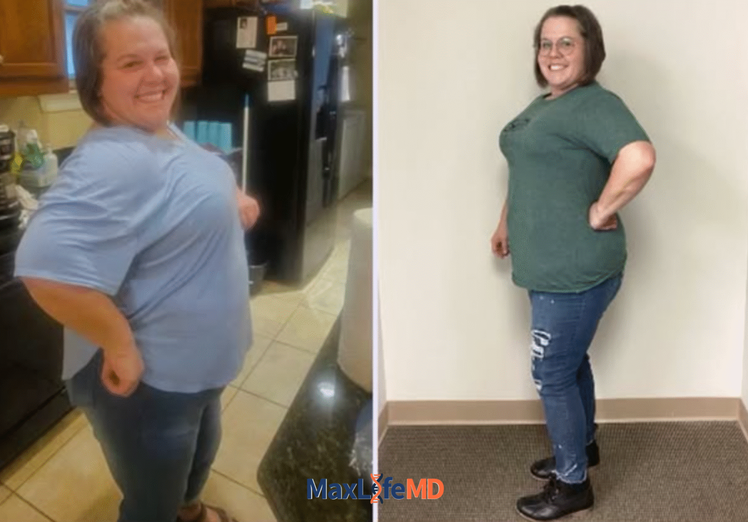 MaxLife MD Website GLP1 Tirzepatide NAD Energy Lose Weight Lose Fat Women 7